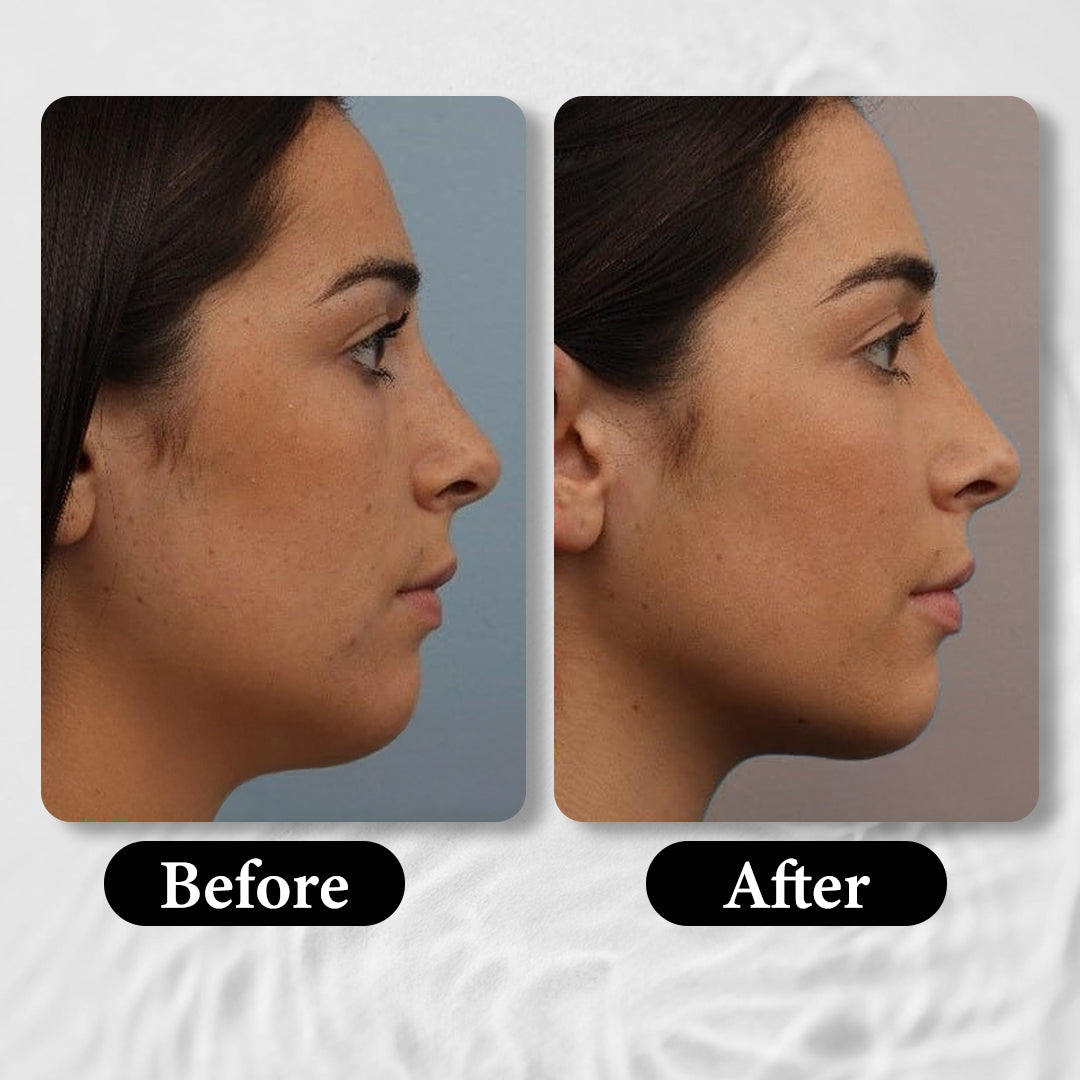 AGE-LESS Anti-aging Face Sculpting Mask - Face Mask for Sagging Skin 50gm